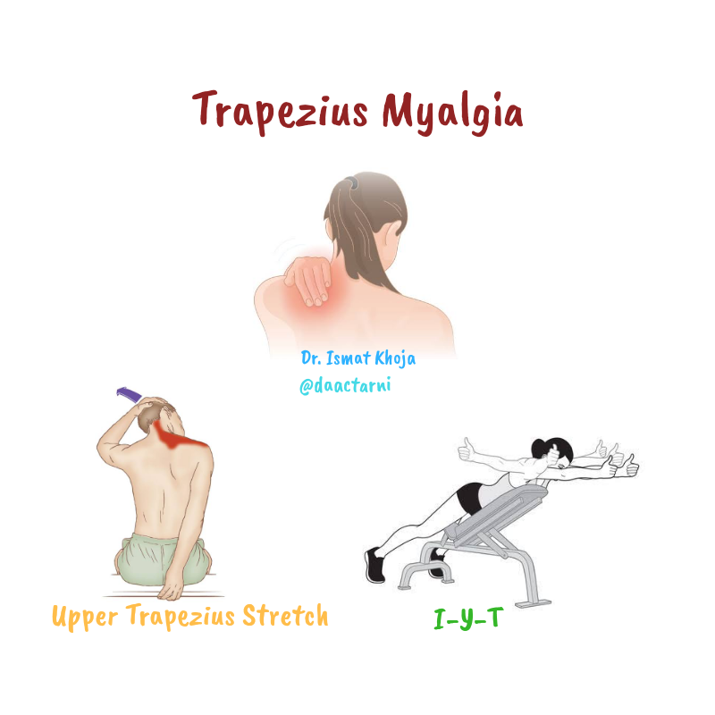 sore trapezius from sleeping